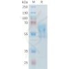 sp-PME M100099 PD 1 Fig.1 SDS PAGE 1