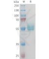 sp-PME M100102 TNFSF15 Fig.1 SDS PAGE 1