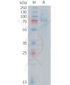 sp-PME M100104 TFRC Fig.1 SDS PAGE 1
