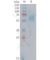 sp-PME M100105 CD98 Fig.1 SDS PAGE 1