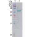 sp-PME M100108 NECTIN 4 Fig.1 SDS PAGE 1