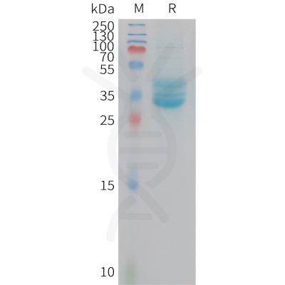 sp-PME M100111 PROM1 Fig.1 SDS PAGE 1