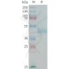 sp-PME100199 CDH17 Fig.1 SDS PAGE 1