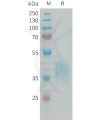 sp-PME100213 CRLF2 Fig.1 SDS PAGE 1