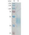 sp-PME100319 KIR2DL3 Fig.1 SDS PAGE 1