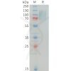 sp-PME100344 MERTK Fig.1 SDS PAGE 1