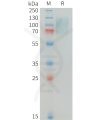 sp-PME100344 MERTK Fig.1 SDS PAGE 1