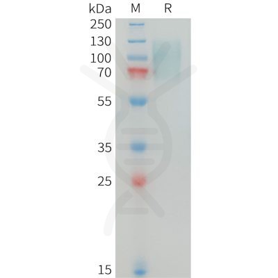 sp-PME100344 MERTK Fig.1 SDS PAGE 1