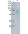 sp-PME100481 CD30 Fig.1 SDS PAGE 1