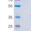 sp-PME100531 SIRPα mFc PAGE 300