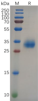 sp-PME100647 S RBD His PAGE 300