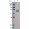 sp-PME100730 CD3DCD3E Fig.1 SDS PAGE 1