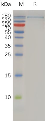 sp-PME100764 ITGAX ITGB2 Heterodimer His PAGE hFc PAGE 300