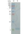 sp-PME100849 CD9 Fig.1 SDS PAGE 1