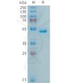 sp-PME100854 APRIL Fig.1 SDS PAGE 1