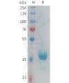 sp-PME100933 CX3CR1 Fig.1 SDS PAGE 1