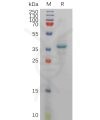 sp-PME100935 CXCL12 Fig.1 SDS PAGE 1