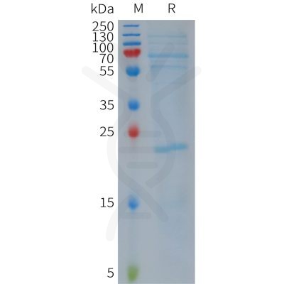 sp-PME101158 NLRP3 Fig.1 SDS PAGE 1