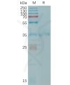 sp-PME101206 CLDN6 Fig.1 SDS PAGE 1