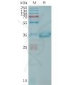 sp-PME101207 CLDN6 Fig.1 SDS PAGE 1