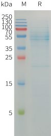 sp-PME101215 SELENOP Fig.1 SDS PAGE 1