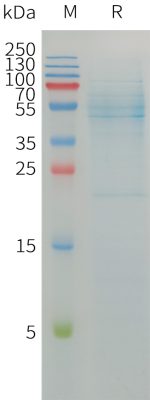 sp-PME101215 SELENOP Fig.1 SDS PAGE 1