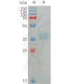 sp-PME101225 AZU1 Fig.1 SDS PAGE 1