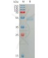 sp-PME101226 ANGPTL7 Fig.1 SDS PAGE 1