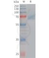 sp-PME101227 ACHE Fig.1 SDS PAGE 1