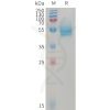 sp-PME101229 CD14 Fig.1 SDS PAGE 1