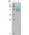 sp-PME101229 CD14 Fig.1 SDS PAGE 1