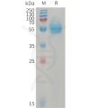 sp-PME101230 CD14 Fig.1 SDS PAGE 1