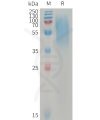 sp-PME101231 LYPD3 Fig.1 SDS PAGE 1