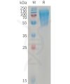 sp-PME101232 LYPD3 Fig.1 SDS PAGE 1