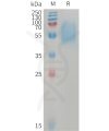 sp-PME101233 ACVR1C Fig.1 SDS PAGE 1