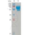sp-PME101234 ACVRL1 Fig.1 SDS PAGE 1