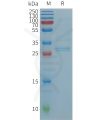 sp-PME101236 CCL19 Fig.1 SDS PAGE 1