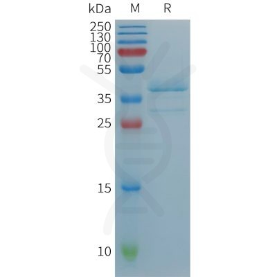 sp-PME101237 TGFA Fig.1 SDS PAGE 1