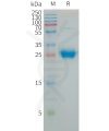 sp-PME101241 CXADR Fig.1 SDS PAGE 1