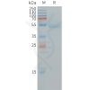 sp-PME101243 RHOB Fig.1 SDS PAGE 1