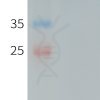 PME101246 human CXADR hFc recombinant protein