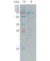 sp-PME101248 IL20RA Fig.1 SDS PAGE 1