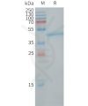sp-PME101251 LY6H Fig.1 SDS PAGE 1