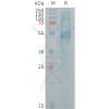 sp-PME101253 KREMEN2 Fig.1 SDS PAGE 1