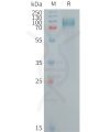 sp-PME101255 GPNMB Fig.1 SDS PAGE 1