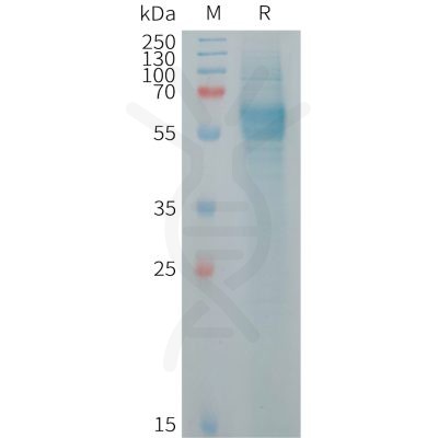 sp-PME101256 FCRL2 Fig.1 SDS PAGE 1
