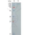 sp-PME101259 CD109 Fig.1 SDS PAGE 1
