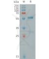 sp-PME101262 CLEC4A Fig.1 SDS PAGE 1