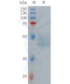 sp-PME101267 GIPR Fig.1 SDS PAGE 1