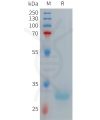sp-PME101271 HAMP Fig.1 SDS PAGE 1